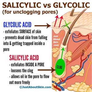 Salicylic Acid vs Glycolic Acid for Unclogging Pores