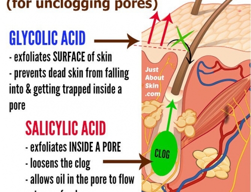Salicylic Acid vs Glycolic Acid For Unclogging Pores
