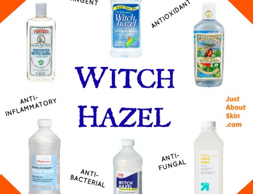 What You Need To Know About WITCH HAZEL TONER