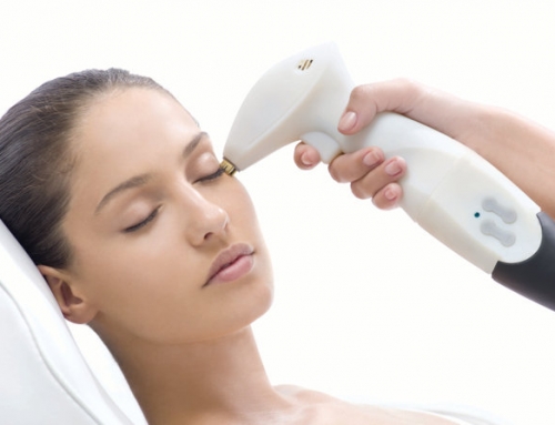 IPL vs Laser – A Guide to Understanding Light Treatments