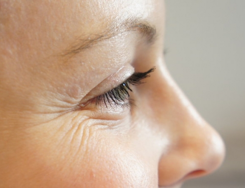 How Wrinkles Form & What You Can Do