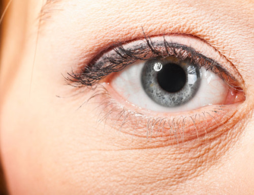 Can Eye Cream Make Skin More Dry?